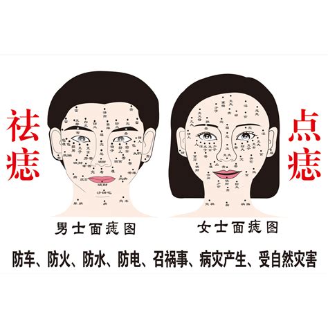 如何消痣